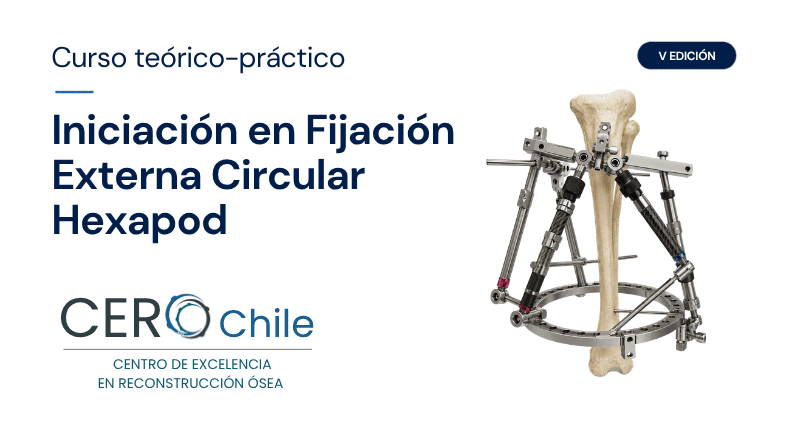 Curso teórico-práctico Iniciación en Fijación Externa Circular Hexapod